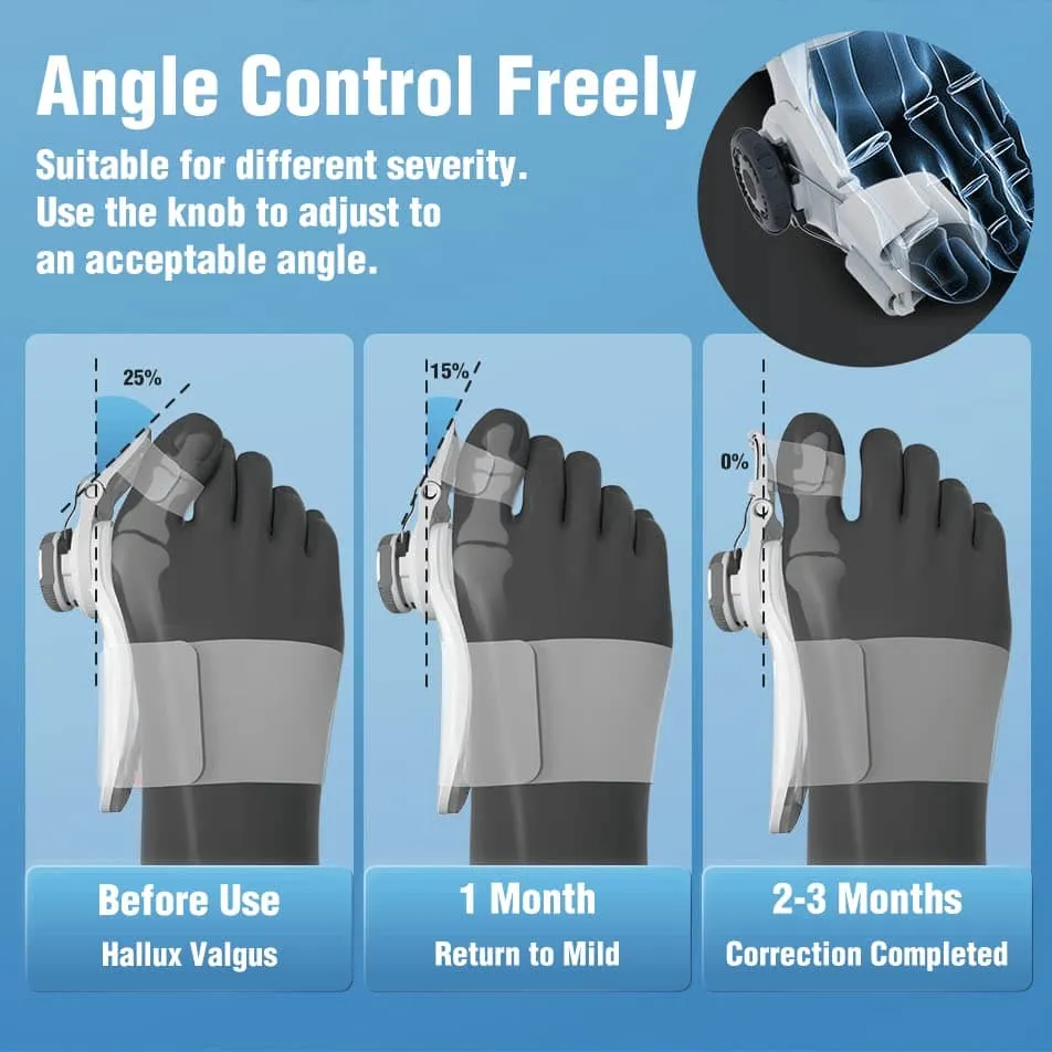 OrthoPro - Bunion Corrector